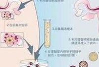 2026试管婴儿三代的费用，附试管价格表